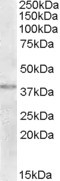 NBP1-20993 - TXNDC6 / TXL2