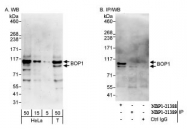 NBP1-21388 - BOP1