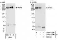 NBP1-21398 - IP3 receptor 1 / ITPR1
