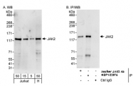 NBP1-22975 - Tyrosine-protein kinase JAK2