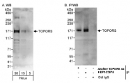 NBP1-22976 - TOPORS