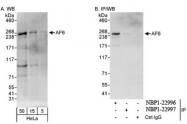 NBP1-22996 - MLLT4 / AF6 / Afadin