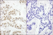 NBP1-23017 - RPA2