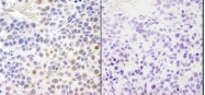 NBP1-23017 - RPA2