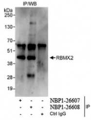 NBP1-26608 - RBMX2