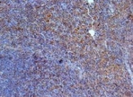 NBP1-28827 - Interleukin-23 receptor / IL23R