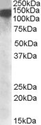 NBP1-28915 - DHX9
