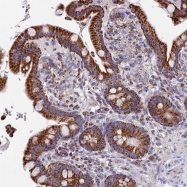NBP1-88933 - NDUFA5