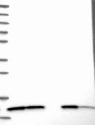 NBP1-88933 - NDUFA5