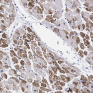 NBP1-86463 - Nebulette / NEBL