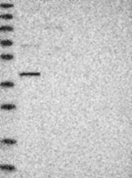NBP1-87764 - NFKBIL2 / IKBR