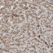 NBP1-85095 - NFRKB / INO80G