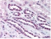 NBP1-77808 - RELA / NF-kB p65