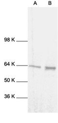 NB100-2176 - RELA / NF-kB p65