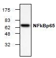 NBP1-45739 - RELA / NF-kB p65