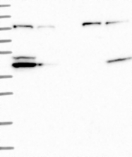 NBP1-84438 - NLRX1 / NOD9