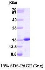 NBP1-40409 - NME2