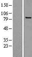 NBL1-13733 - NOX5 Lysate