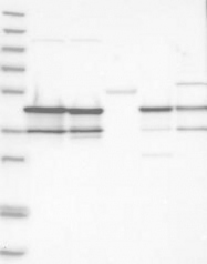 NBP1-89517 - NUDC