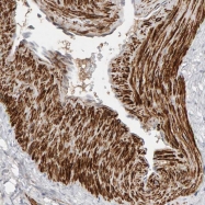 NBP1-85539 - NUDCD1 / CML66