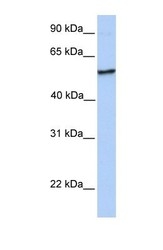 NBP1-55000 - NUDCD1 / CML66