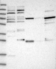 NBP1-85539 - NUDCD1 / CML66