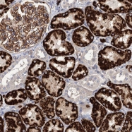 NBP1-84118 - NUDCD2