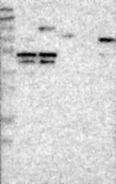 NBP1-82938 - NUDCD3