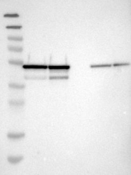 NBP1-82939 - NUDCD3