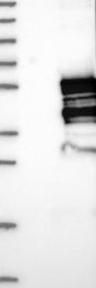NBP1-82940 - NUDCD3