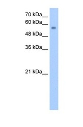 NBP1-52974 - NUDT12