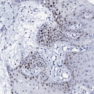 NBP1-92207 - NUDT13