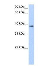 NBP1-54929 - NUDT13