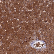 NBP1-92209 - NUDT16L1 / SDOS
