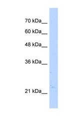 NBP1-55432 - NUDT16L1 / SDOS