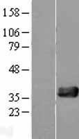 NBL1-13858 - NUDT18 Lysate