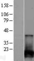NBL1-13859 - NUDT2 Lysate