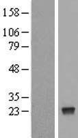 NBL1-13863 - NUDT4 Lysate