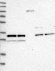 NBP1-83131 - NUDT5