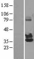 NBL1-13865 - NUDT6 Lysate