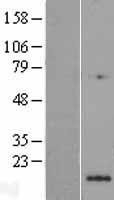 NBL1-13866 - NUDT6 Lysate