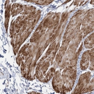 NBP1-82715 - NUDT9 / NUDT10