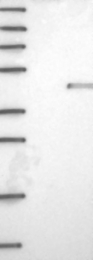 NBP1-82715 - NUDT9 / NUDT10