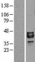NBL1-13867 - NUDT9 Lysate
