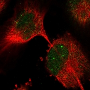 NBP1-82516 - NUFIP1