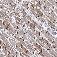 NBP1-82515 - NUFIP1