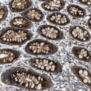 NBP1-89403 - NUFIP2