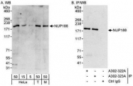 NBP1-28717 - NUP188
