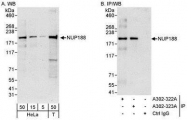 NBP1-28748 - NUP188