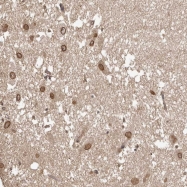 NBP1-88791 - NUP43